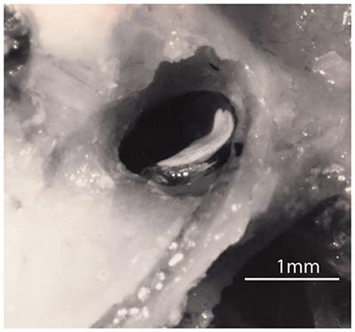 The Anatomical and Physiological Basis of Clinical Tests of Otolith Function. A Tribute to Yoshio Uchino